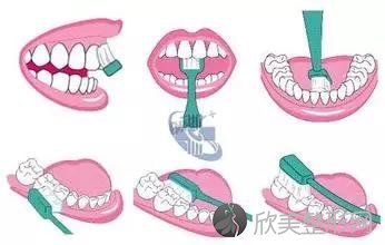 牙齿保健也得分阶段！如何来护齿？