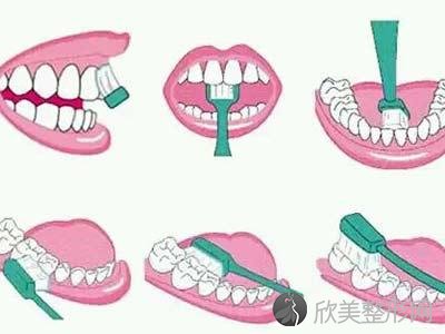 「重在预防」日常牙齿护理的简单方法！