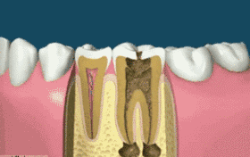 牙齿松动怎么办？这几种方法你要知道！