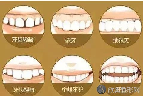 牙齿松动怎么办？这几种方法你要知道！