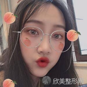 保定珍润医疗美容诊所吴琼医生怎么样?眼综合顾客反馈案例-收费标准