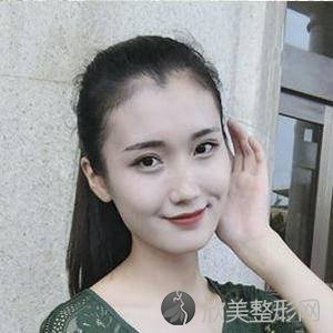 北大崔永言取生长因子怎么样?水光针术前术后图