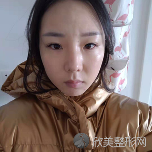 北大深圳医院胡华新隆胸怎么样？?下颌角附收费标准