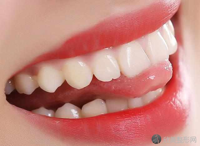 哪些小方法可以让牙齿变白起来？