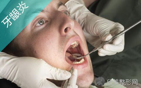 如何有效预防牙龈炎？