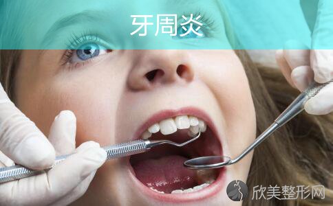 教你几招轻松预防牙周炎！