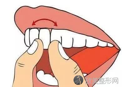 牙齿松动能固定吗，有什么加固办法？