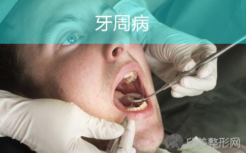 牙周病侵袭牙齿掉落，你还能淡定嘛?