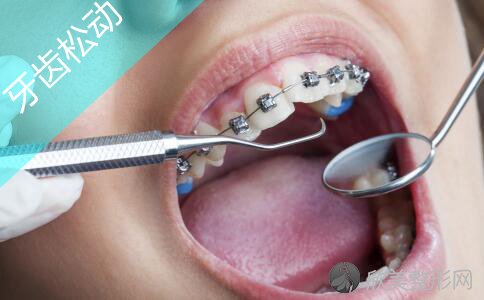 牙周炎怎么治疗才能痊愈呢？