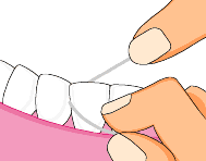 牙线的使用方法（图解）
