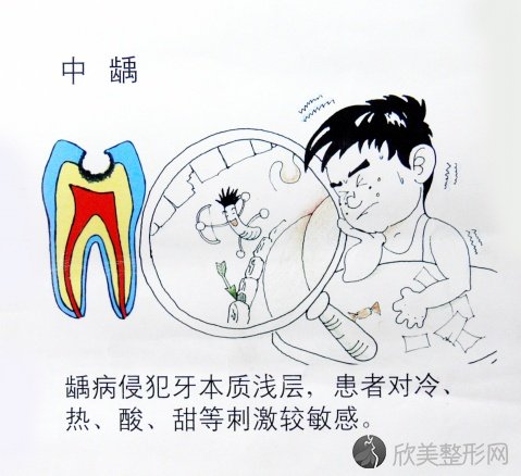 保护牙齿很重要！
