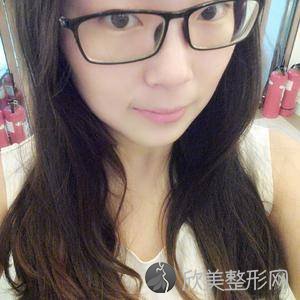北京东方和谐冯斌吸脂好吗?光子嫩肤价格表-术前术后图