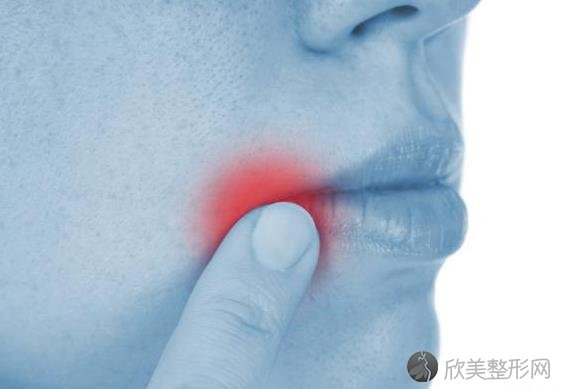 口腔溃疡是不治之症吗，靠哪些办法可以缓解口腔溃疡？