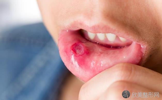 口里总是爱长泡，可能口腔“惹恼”了5种疾病，别大意！
