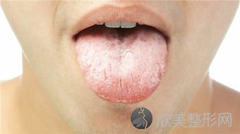 这6种口腔异味，代表不同器官的疾病，请你及时检查！