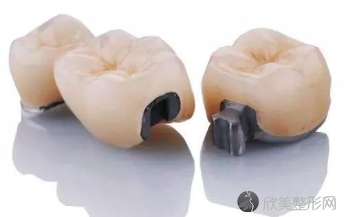 都是同一个医生做的假牙，为什么效果就不一样呢？
