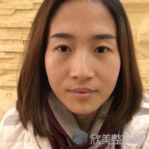 北京丽都吴玉家全鼻再造案例?自体脂肪面部填充地址-价格在线查询