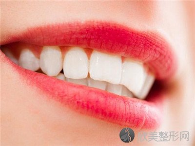 门牙被磨后的对比照片，磨门牙能改善大板牙吗？