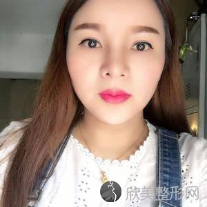 北京联合丽格较好医疗美容医院吴焱秋怎么样?自体脂肪面部填充顾客反馈对比