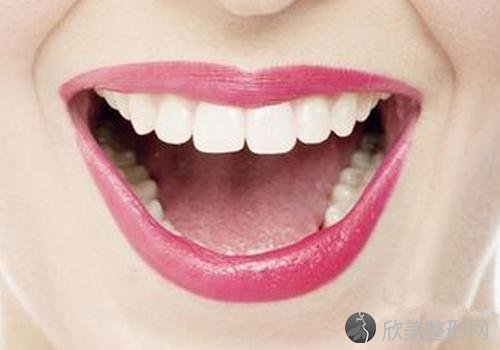氟斑牙可以冷光美白吗？