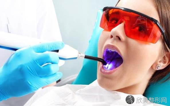 为何要定期洗牙？洗牙后牙齿为何会酸软？