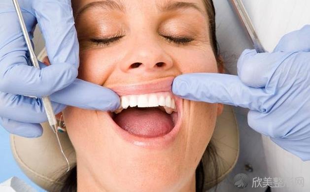 洗牙会经历这4个步骤，并不是想象那么简单！