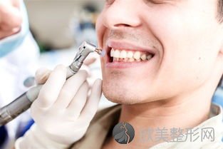 洗牙后牙齿酸痛？你可能需要一份洗牙后的护理指南！