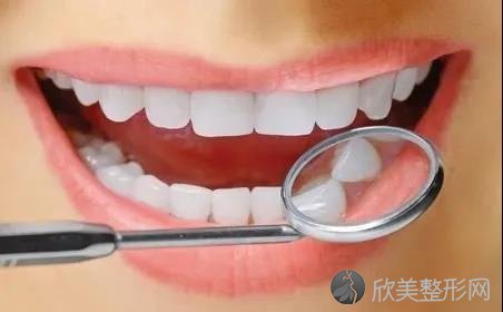 10个关于牙齿美白的常见问题！