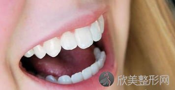 全瓷牙的适应症有哪些？