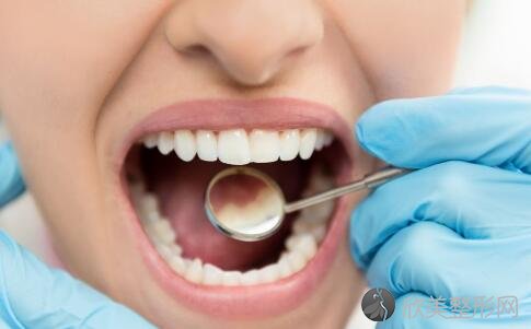 蛀牙的症状表现有哪些？