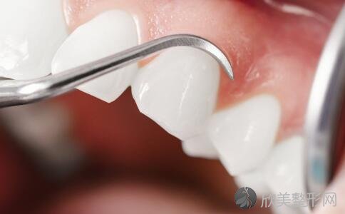 诱发牙痛的几种常见原因！