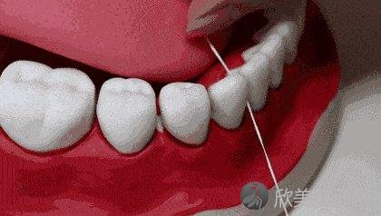 几个简单的牙齿健康护理技巧，让你在家就可以轻松实现！