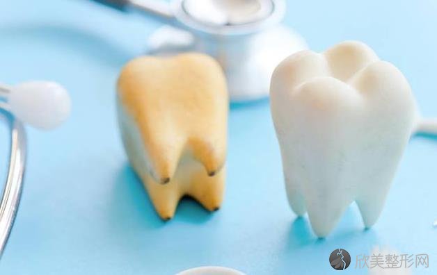 你还在为你的牙黄而苦恼吗？全面解析牙黄原因及解决方法！