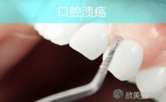 口腔溃疡变这样，距离口腔癌，有多远？