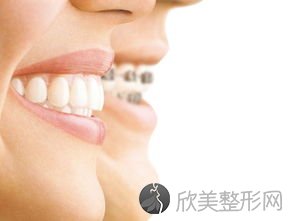 牙齿矫正有哪些危害？