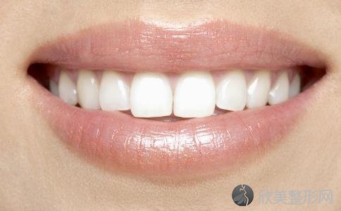 牙齿矫正方法有哪些，矫正牙齿试试这5招！