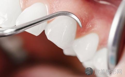 牙齿矫正方法有哪些，矫正牙齿试试这5招！
