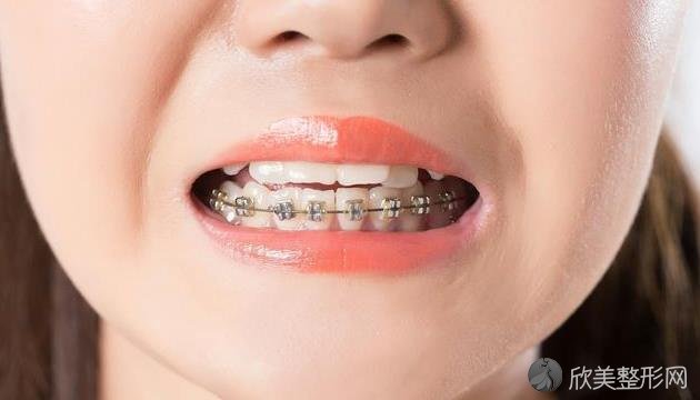 牙齿矫正靠谱吗？这三种方法，还你一口整齐牙齿！
