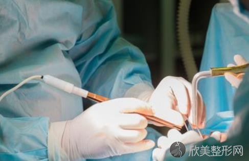 上海抽脂手术价格是多少