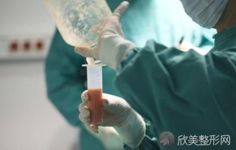 上海抽脂手术大概花多少钱