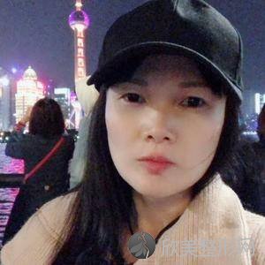 北医三院李东隆鼻怎么样?自体脂肪面部填充三个月术前术后图-价格表更新
