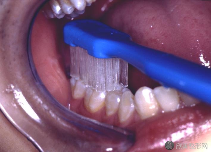 想要彻底清洁牙齿该怎么做？