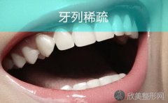 牙列稀疏的原因和治疗方法是什么？