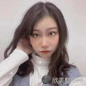 北医三院赵润蕾面部填充怎么样?双眼皮案例反馈-收费标准