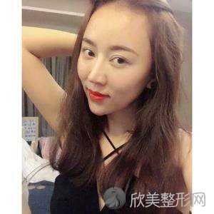 北医三院赵旬光子嫩肤怎么样?玻尿酸面部填充顾客术后反馈案例-收费标准