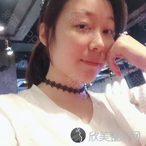 北医三院整形科张颂怎么样?自体脂肪面部填充顾客反馈案例-收费标准