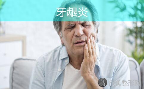 什么是边缘性牙龈炎，有哪些症状和治疗方法？