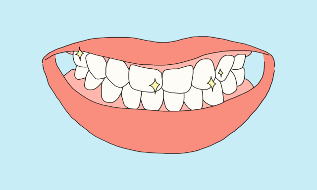 牙齿矫正从效果来看，是固定矫正好？还是隐形矫正好？