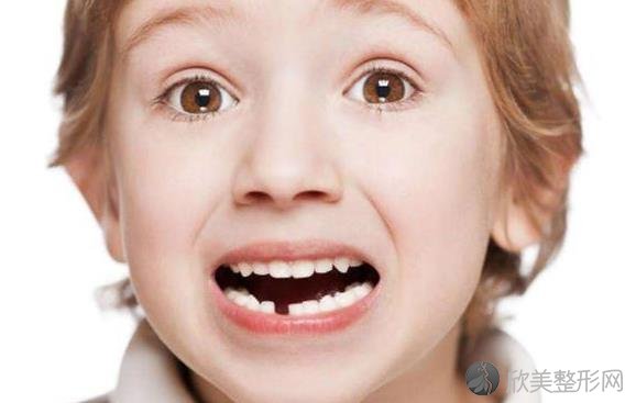 牙齿不齐是哪些因素造成的，家长怎样做才可为孩子矫正牙齿？