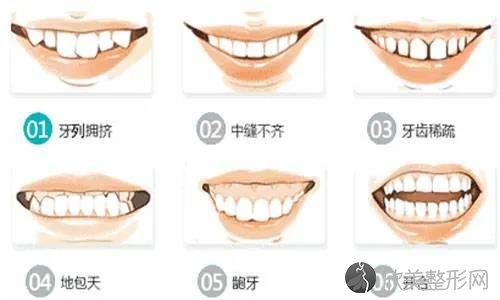如何缩短矫正牙齿的时间？